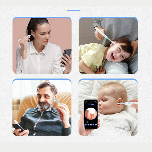 WaxRemover™ - Smart öronrengöring med HD kamera